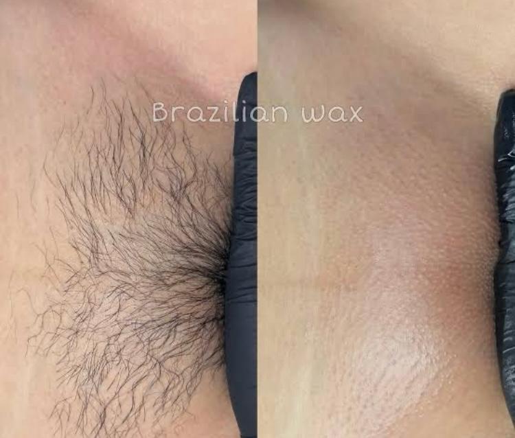 Brazilian Waxing: Everything You Need to Know Before Your First Appointment